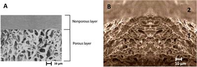 Bilaminar Chitosan Scaffold for Sellar Floor Repair in Transsphenoidal Surgery